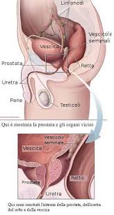 prostatita incontinenta